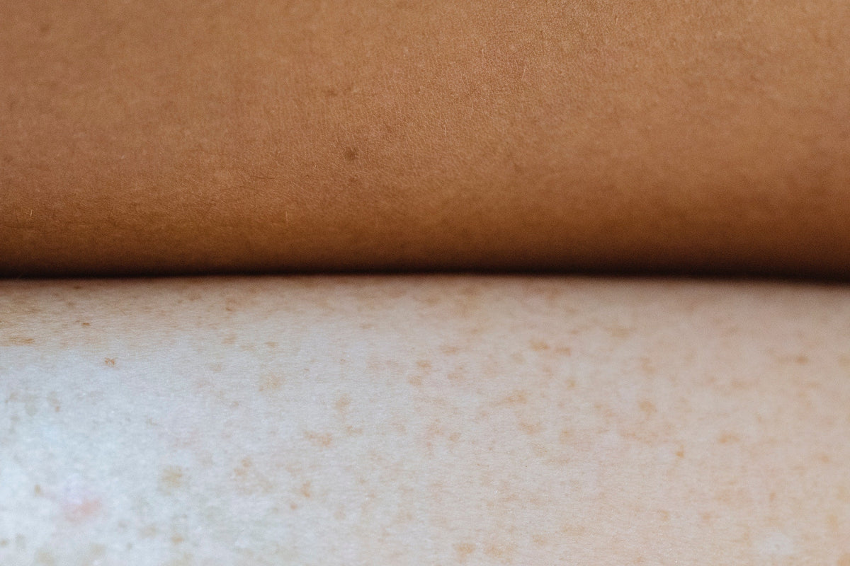 All Skin Types